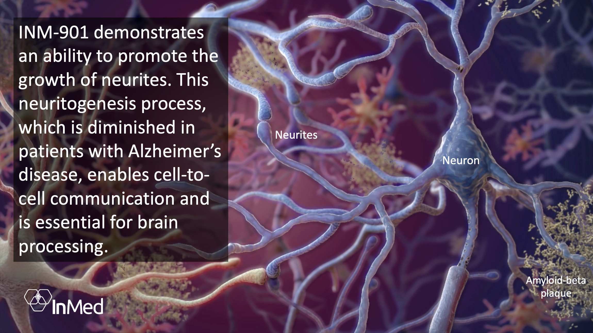 InMed's INM-901 Under Development for Alzheimer's Disease